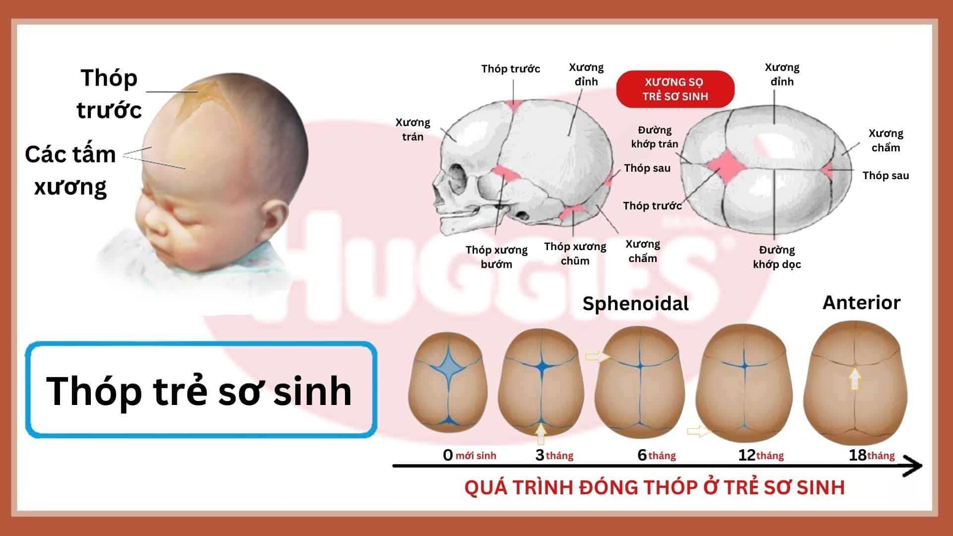 thop-truoc-dong-khi-nao-1-1733675162.jpg