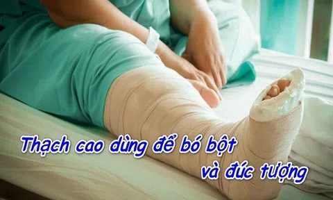 Hợp Chất Nào Của Canxi Dùng Để Đúc Tượng, Bó Bột? Giải Đáp & Ứng Dụng!