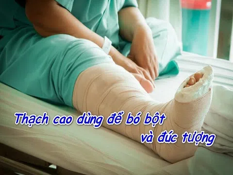 Hợp Chất Nào Của Canxi Dùng Để Đúc Tượng, Bó Bột? Giải Đáp & Ứng Dụng!